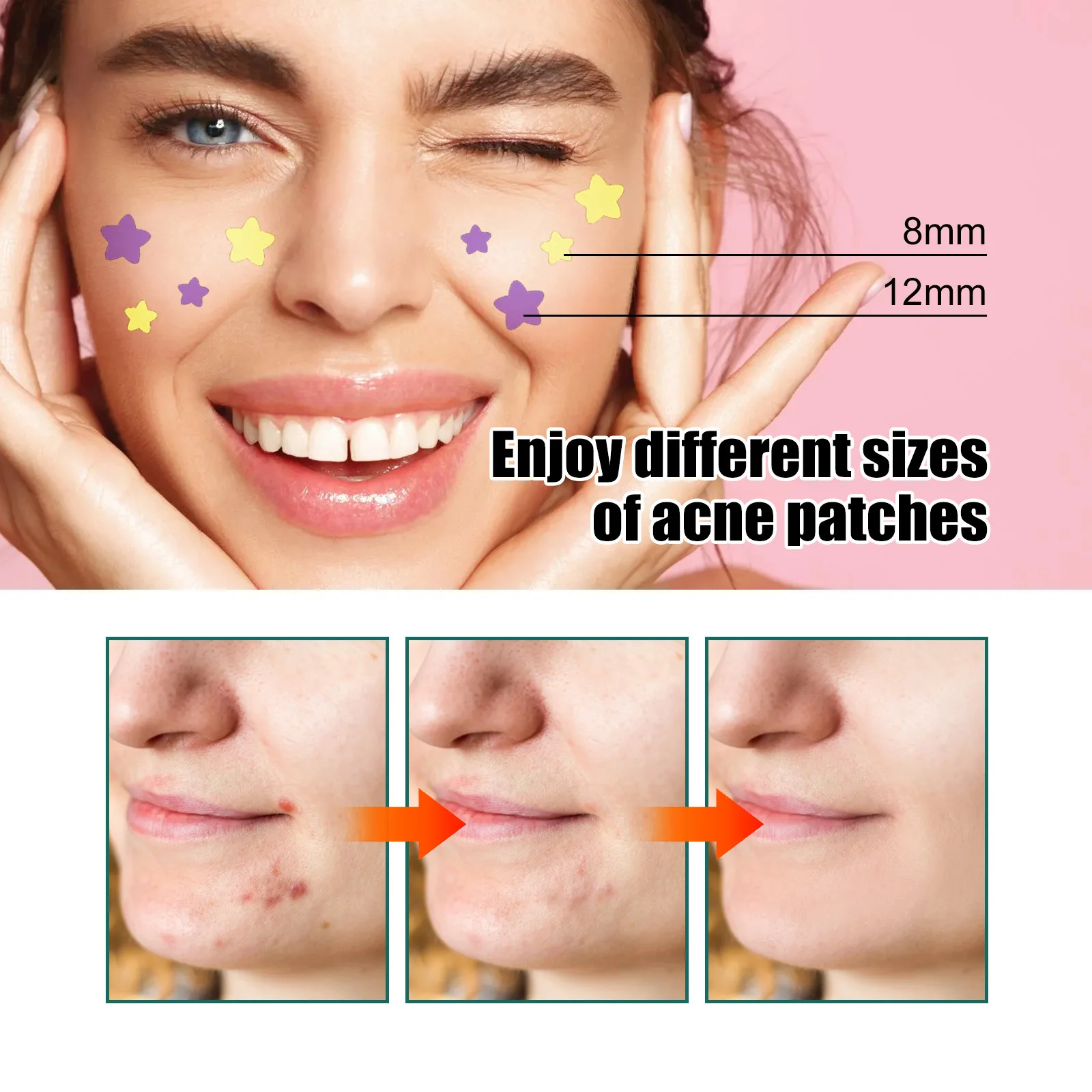 Mini Star Butterfly Invisible Acne Removal Pimple Patch Beauty Acne Tools Pimple Originality Concealer Face Spot Beauty Makeup