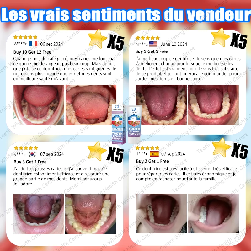 Vendita calda, necessità di molte persone, ripara la carie dei denti e mantiene i denti sani 2026