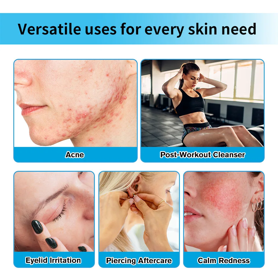 رذاذ الإسعافات الأولية للوجه - رذاذ إنقاذ البشرة المهدئ والترطيب، لوشن تنظيف مرطب لتخفيف البشرة #4