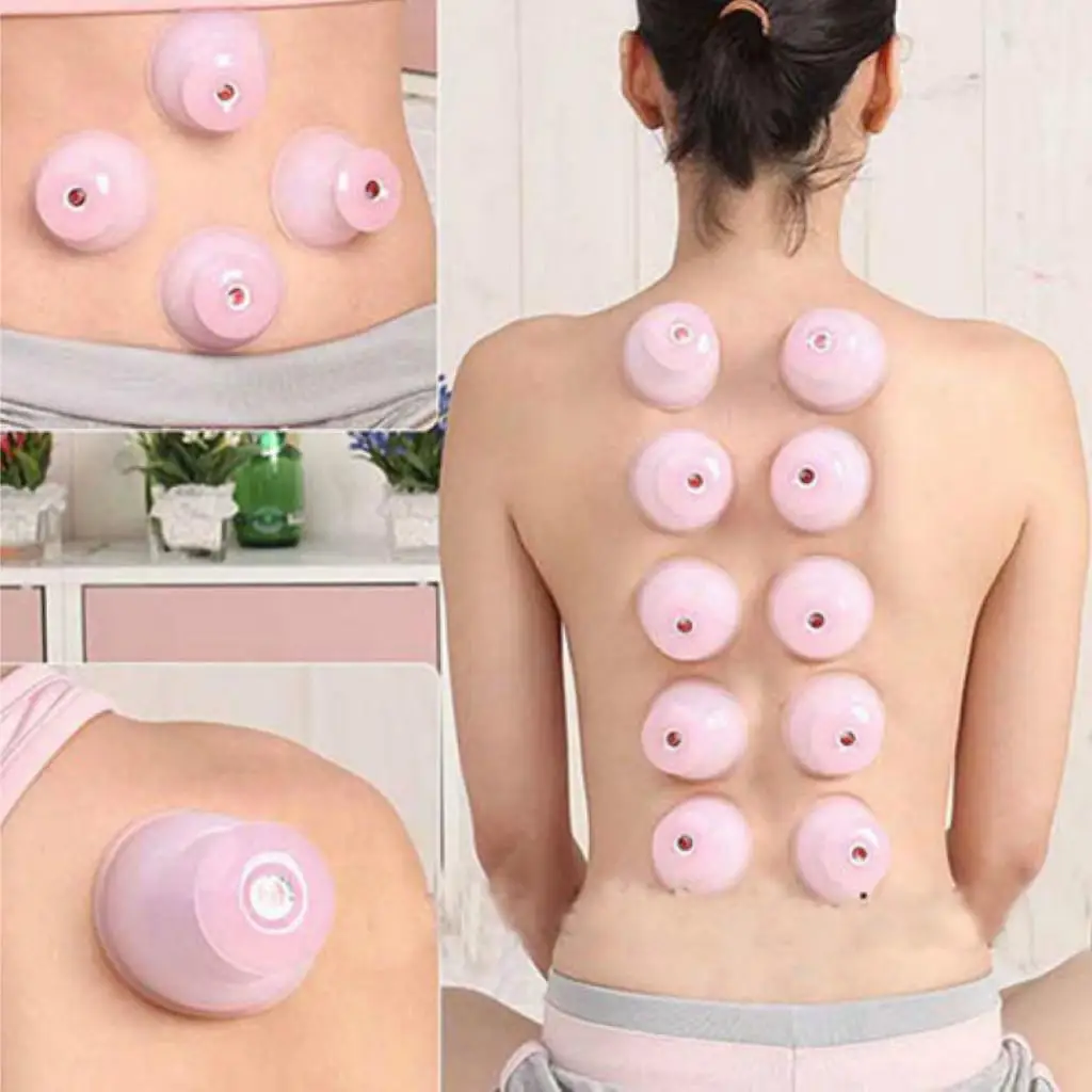 Professional Chinese Cupping Cup Anti- Silicone Massage Cups