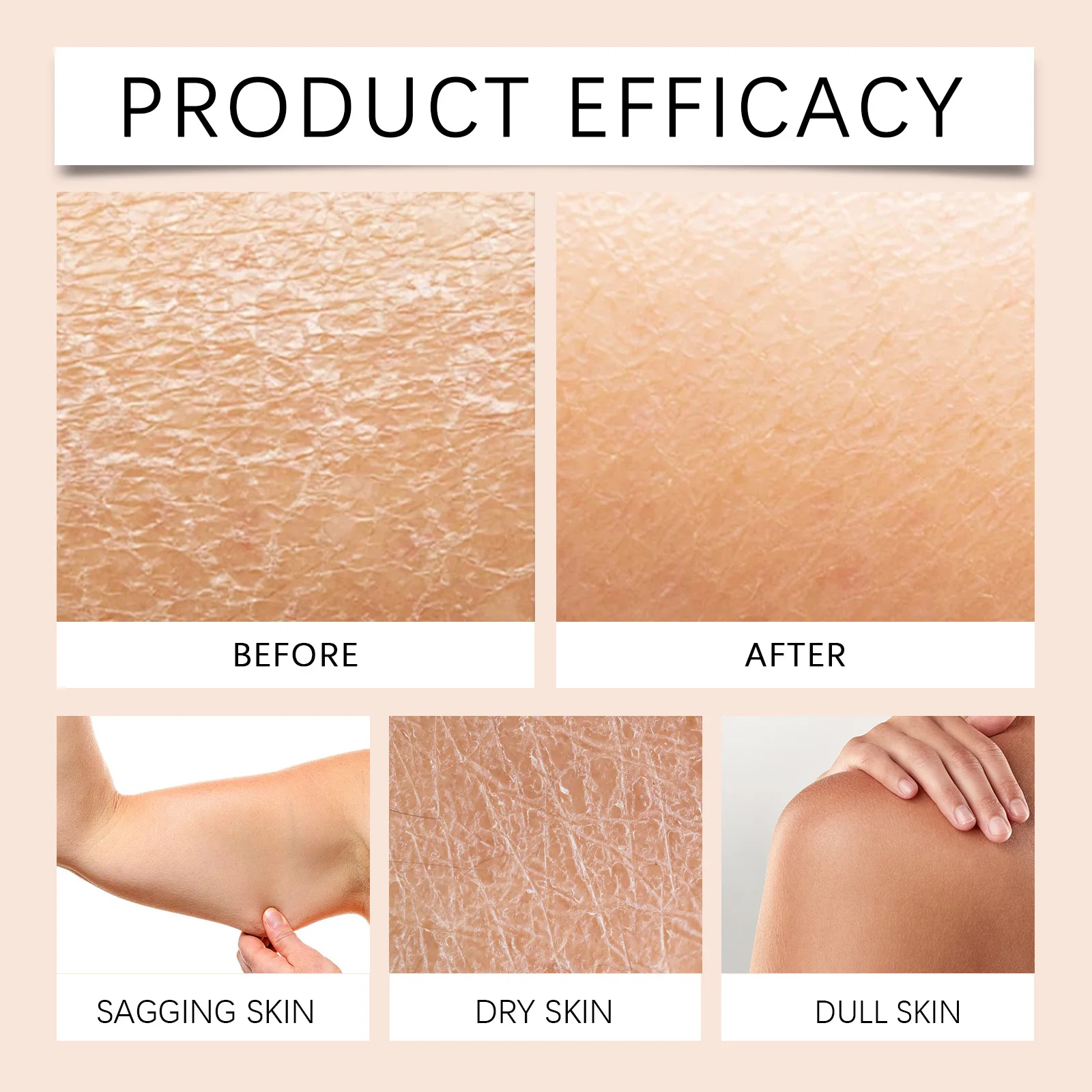 Shea Butter Moisturizing Cream,Double-Oil Deep Nourishment,Body&Face Firming Anti-Aging, Instant Relief For Strawberry Legs&KP Whipped Butter Texture,Preventing & Fading  Marks,Ultimate 48H Skin Barrier Rescue,Suitable For All Skin Types.
