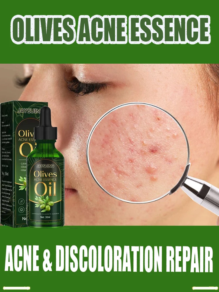 

Skin Care Moisturizing Oil Acne Removal Serum Shrink Pores Oil-Control Brighten Serum,Diminish Acne, Repair Redness
