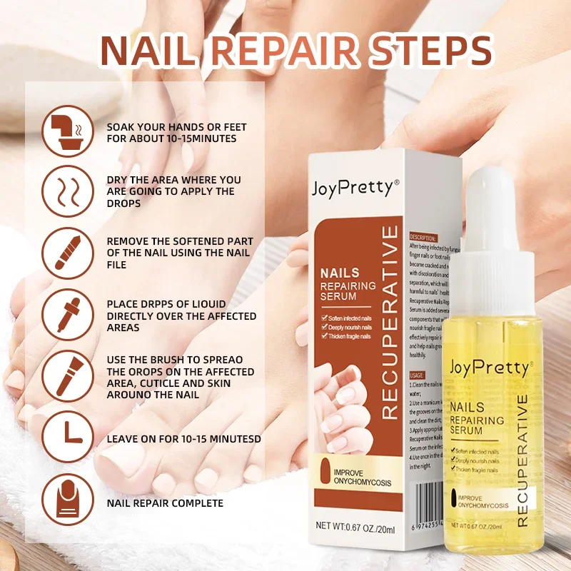Sérum de traitement antifongique pour les ongles des pieds, gel réparateur pour l'élimination des champignons, anti-infection, paronyamitié onychomycose, liquide de soin des pieds, N64.