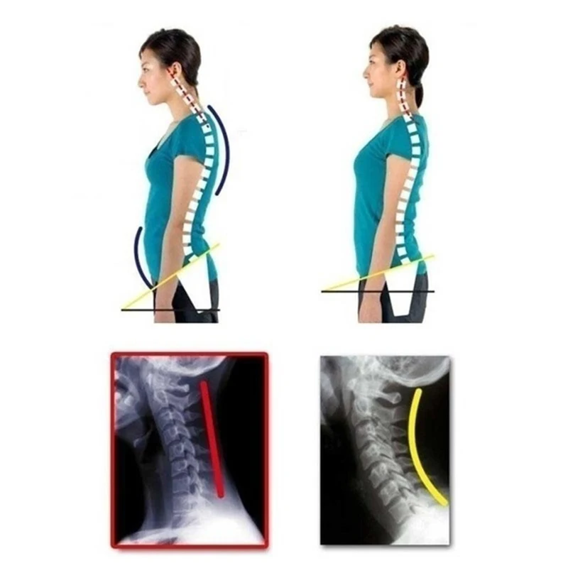 Back Support Posture Correction Adjustable Brace Support Belt Adjustable Back Posture Back Shoulder Chest Corrector Vest Posture