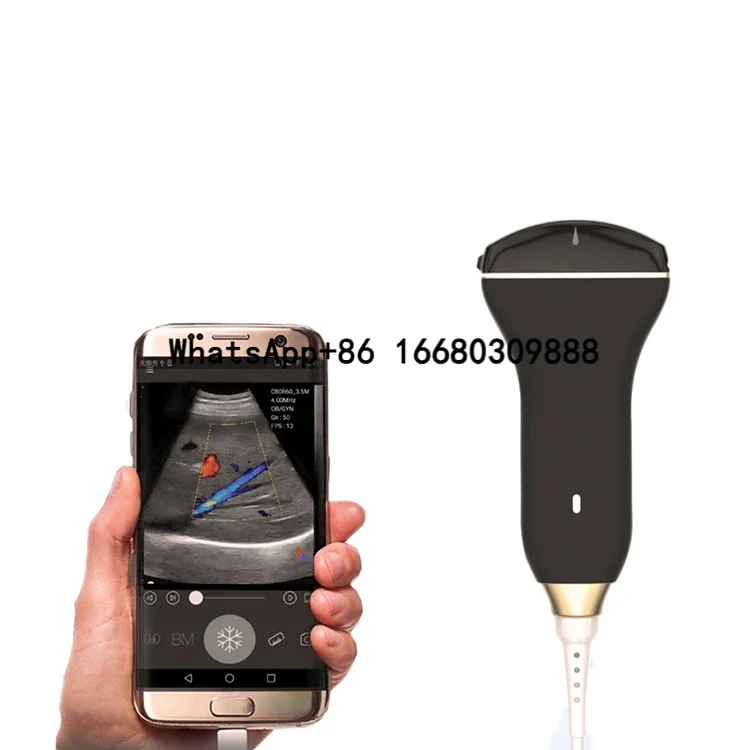 

Factory price medical healson C30C convex handheld ultrasound probe