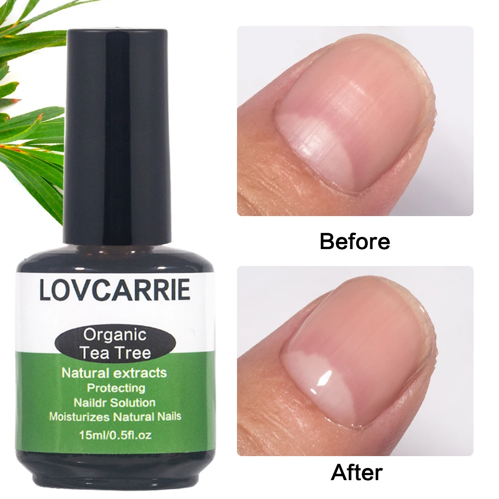 Lov carrie Bio-Teebaum Nagel hautöl Nagel reparatur lösung 15ml natürliche Feuchtigkeit erweichen Nagel verstärker heilen trockene Nägel Haut