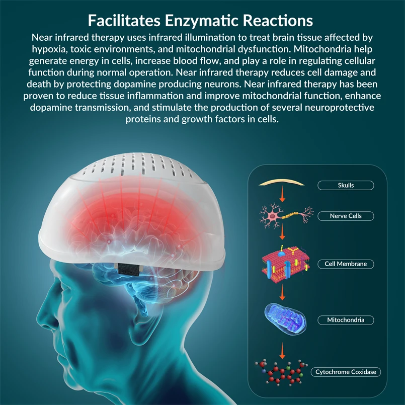 1070nm Infrared Helmet Parkinson's Neuromodulacion Brain Wave Photobiomodulation Therapy Device for Stroke Patients Treatment