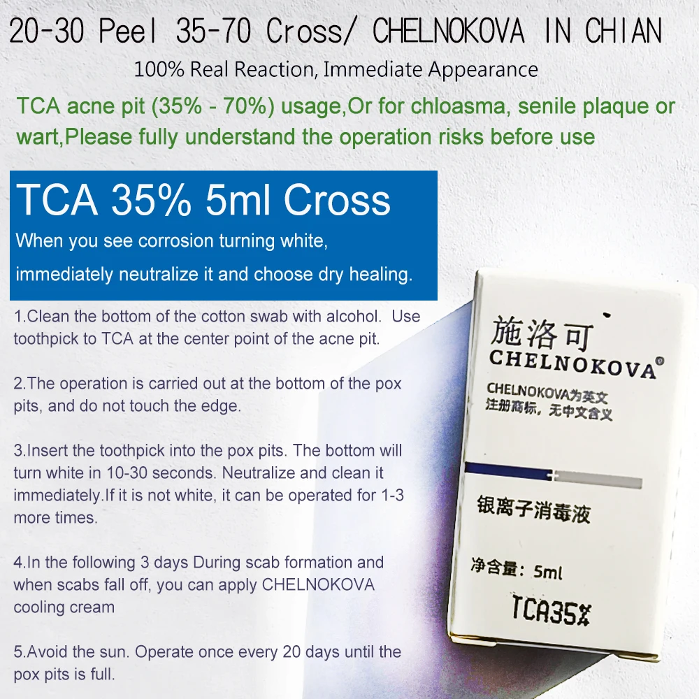 Chelnokova TCA 35 35% ปอกเปลือกกรดที่แข็งแกร่ง5มล. ส่วนลดเพิ่มเติม gratis ongkir ผิวปอกมือเท้ามือไฟล์กลับ