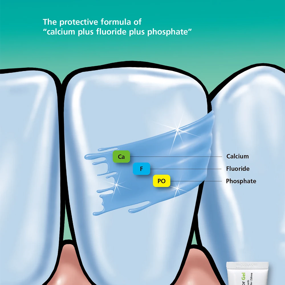 Fluor Protector Dental Supplies Strengthen Teeth Calcium Fluoride Tooth Sensitive Gel Pain Treatment Relief Oral Care Ivoclar