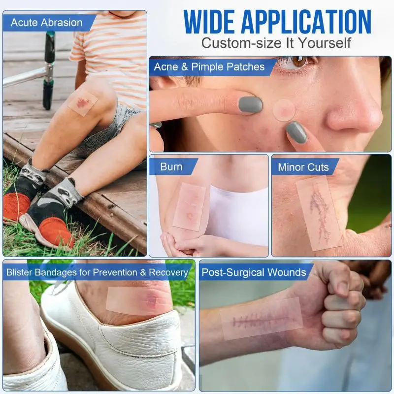 1Roll Hydrocolloid Patch Roll Cuttable  Cover Sticker Ultra Thin Waterproof Facial Blemish Tape