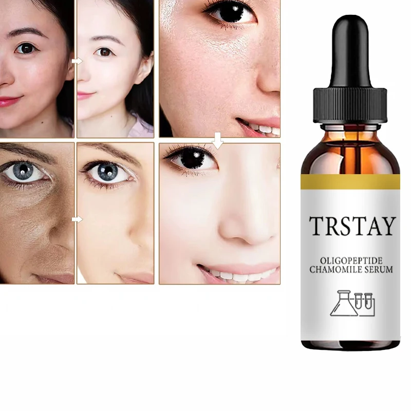 TRSTAY, олигопептид экстракт ромашки, подтягивает кожу, осветляет тон кожи и делает кожу мягкой и нежной