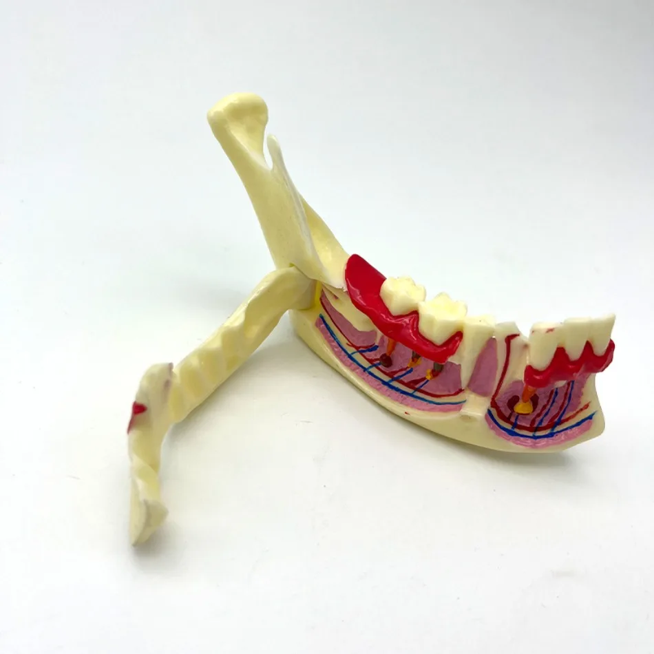 

Dental Mandibular Model Oral Teaching Demonstration Decomposed Model Doctor-patient Communication