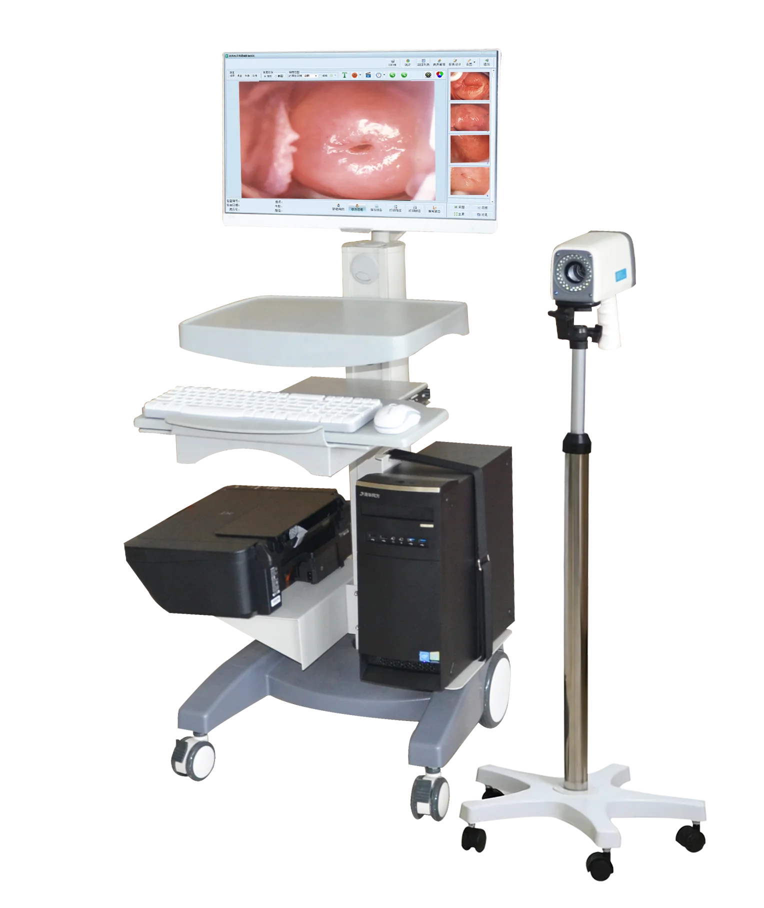 HD digital video  for gynecology colposcopy for vagina