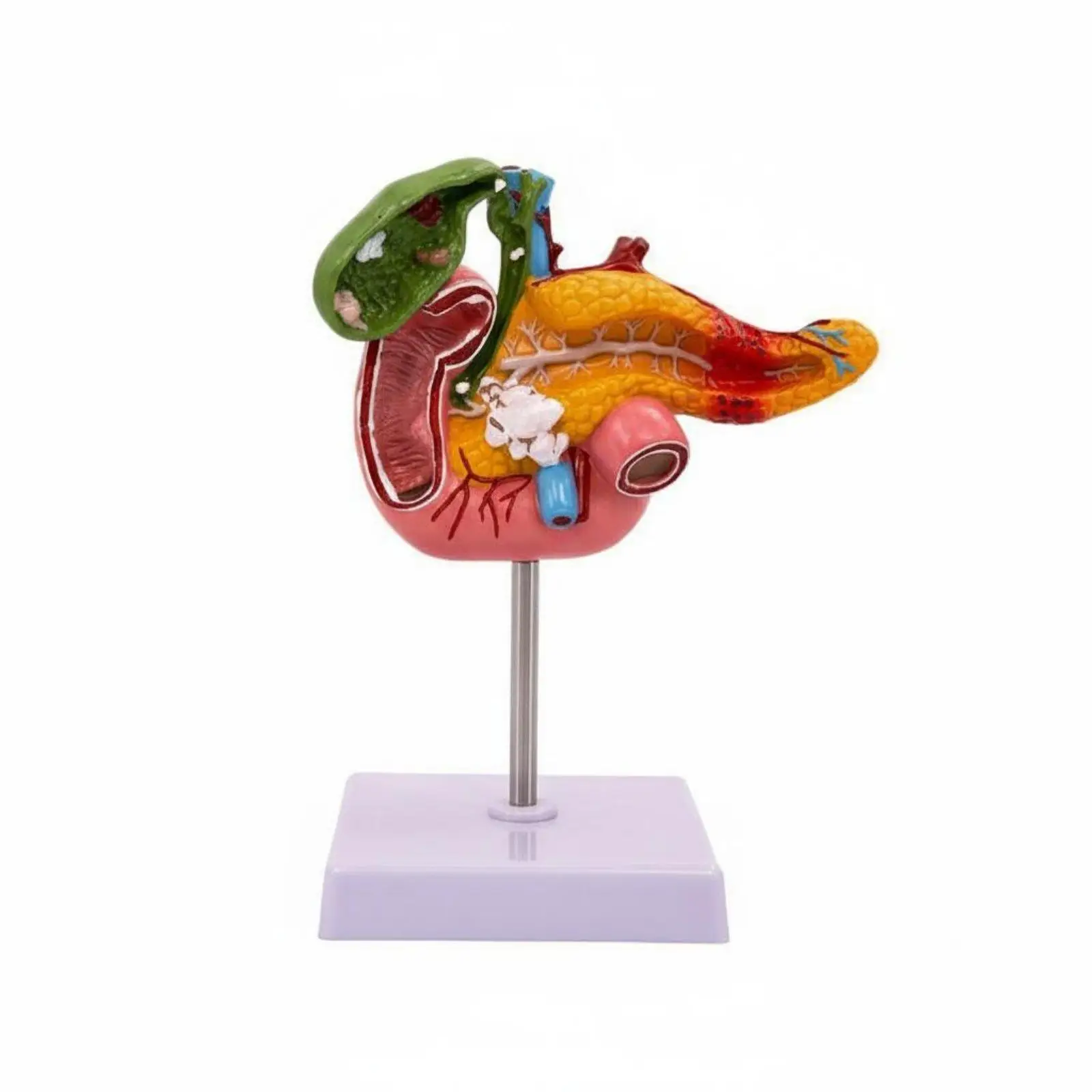 Digestive System Pathology Model Display Pancreas Duodenum Gallbladder Model Anatomically Accurate Teaching Aid for Classroom,