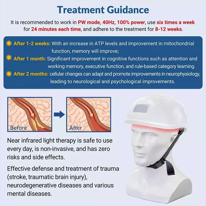 ZJKC 1070nm Terapia de luz infravermelha vermelha e próxima Fotobiomodulação cerebral para acidente vascular cerebral Parkinson Ansiedade Alzheimer Capacete LED