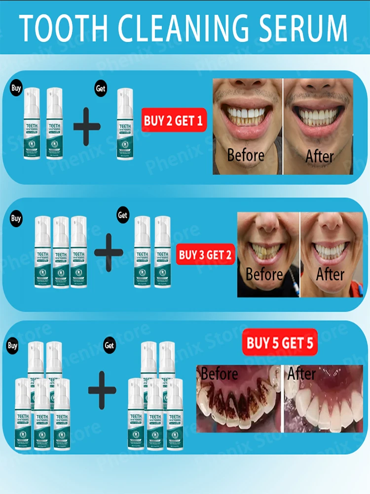 Reparación de caries dentales, eliminación de manchas de placa, blanqueamiento dental