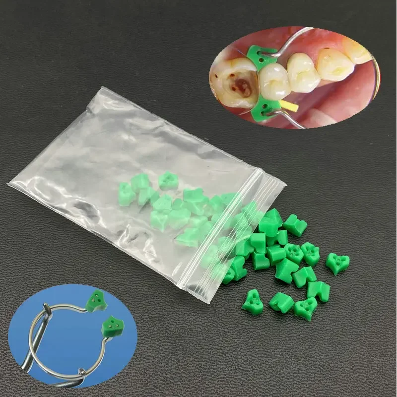 40pcs/bag Dental Silicone Wedges Add On Wedges Rubber No 1.861 Delta Ring Tine Dentist Material Dentist Tools