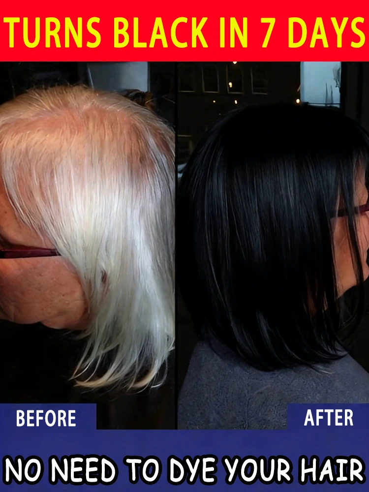Black hair essence, promotes black hair growth, and improves gray hair by turning it black through plant extracts.