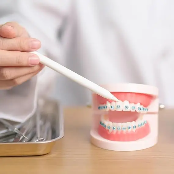 Modische Zahnspangen, bunt, 1 Paar, temporäre Zahnverzierung mit Metalldrähten, Metallhalterungen, kieferorthopädische Ligaturen, hohe Qualität – Detail 6
