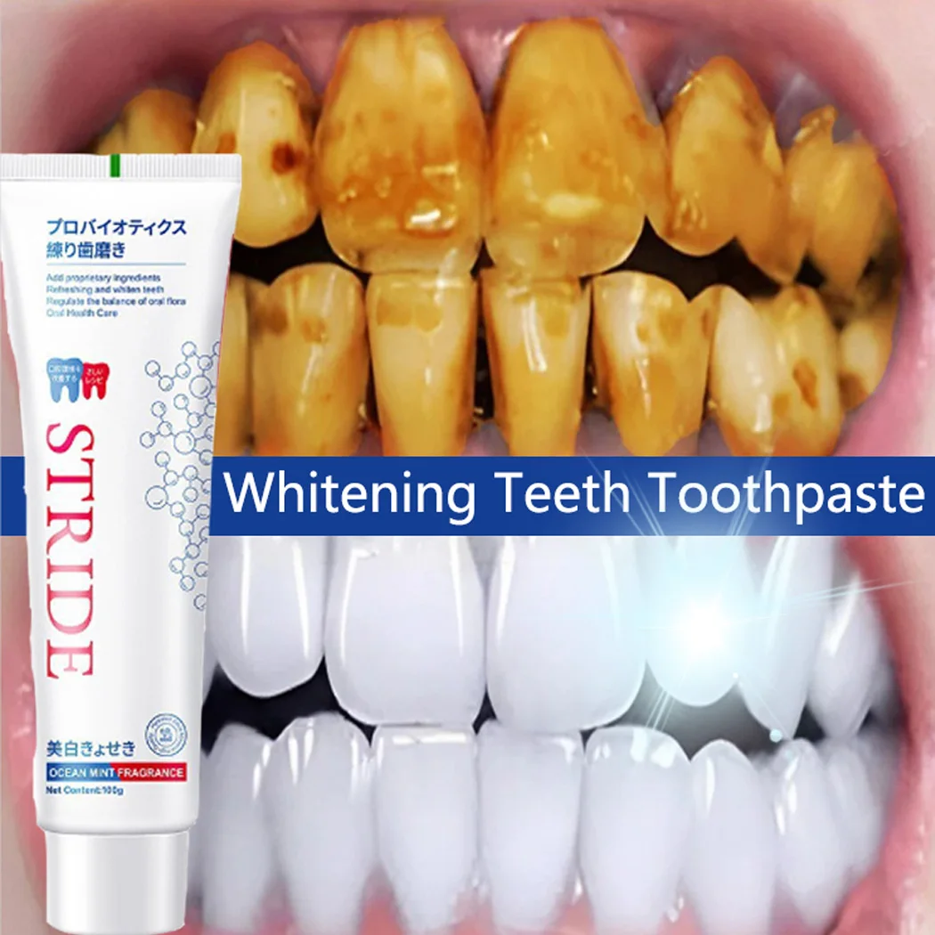 

Whitening Teeth Toothpaste Dental Calculus Remover Fresh Breath Brightening Preventing Periodontitis Dental Cleansing Care New