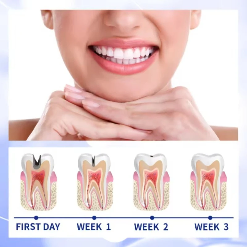 1 x rotierender Zahnreinigungsstift, tragbar, zum Entfernen gelber Flecken, erfrischender Atem, Lächeln, Mundreinigung und Hygienepflege