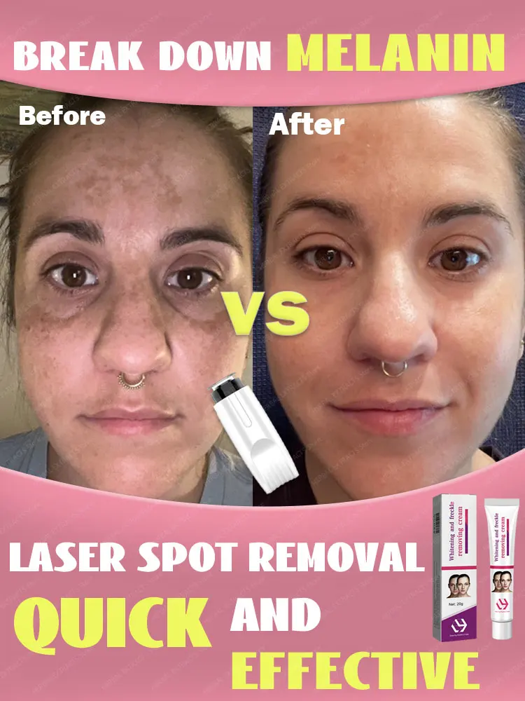 The most effective spot remover of 2025. Certified by experts to reduce dark spots.