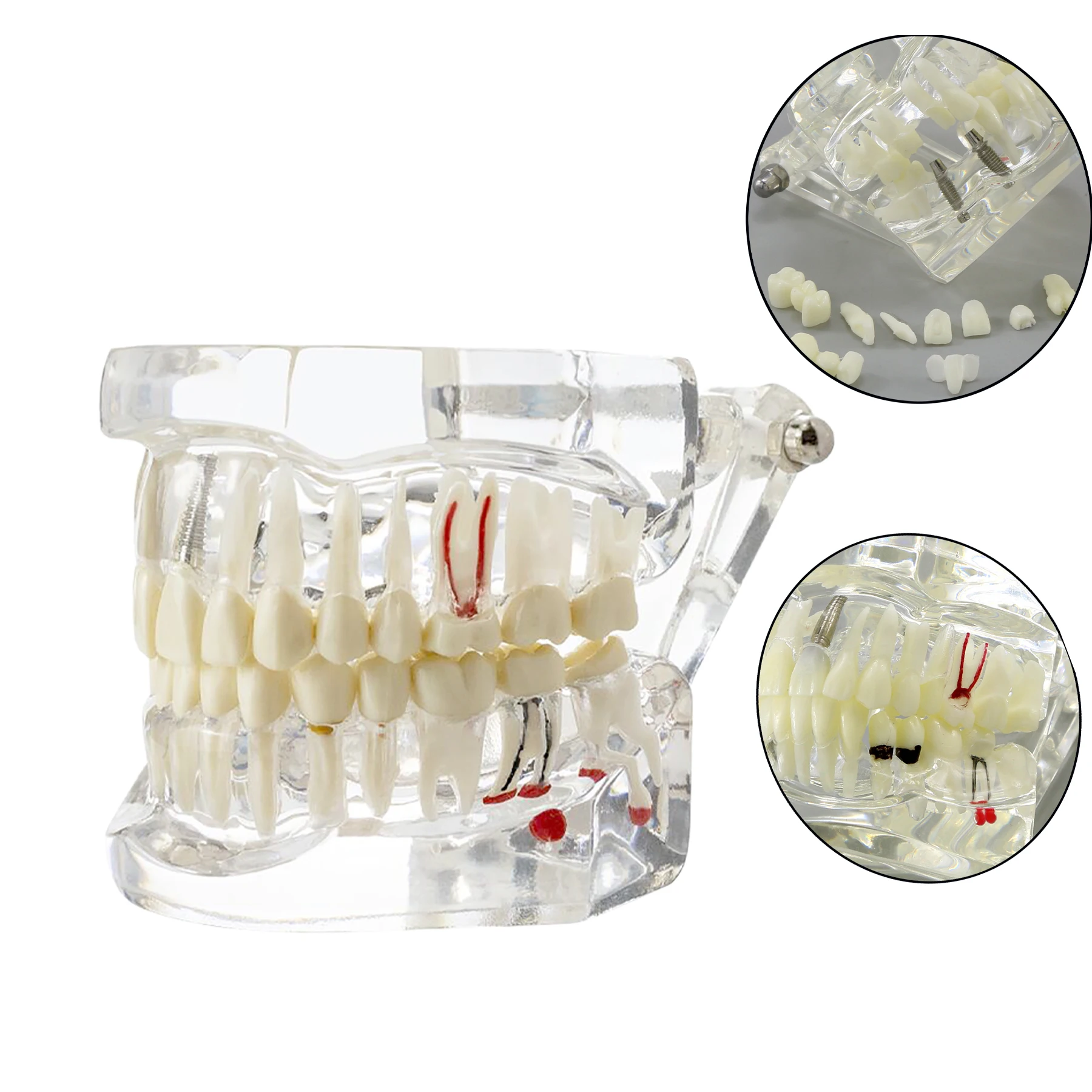 Thumbnail 2 - #63 Dental Teaching Models List of Top Picks