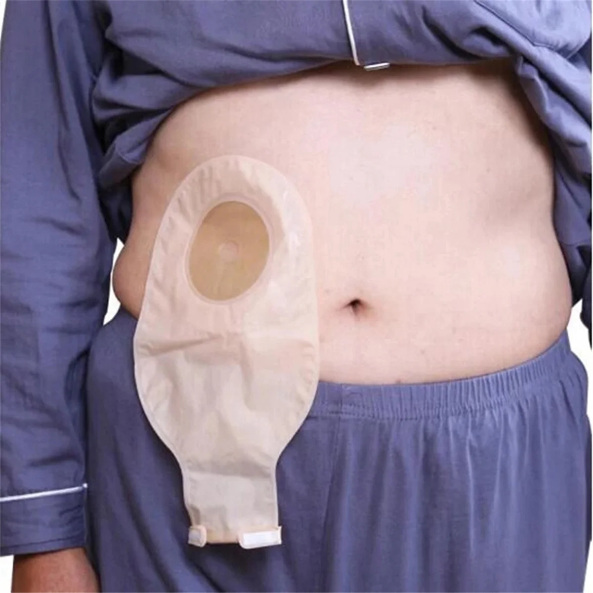 

5Pcs Ostomy Bags One Piece Drainable Pouches for Colostomy Ileostomy Stoma Care 20-60mm Drain Valve Colostomy Bags
