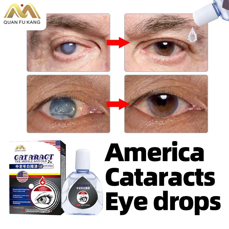 

Cataract Removal Eye Drops Blurred Vision Treatment Apply To Pain Dry Itchy Eyes Fatigue Cleaner Medicine American Formula