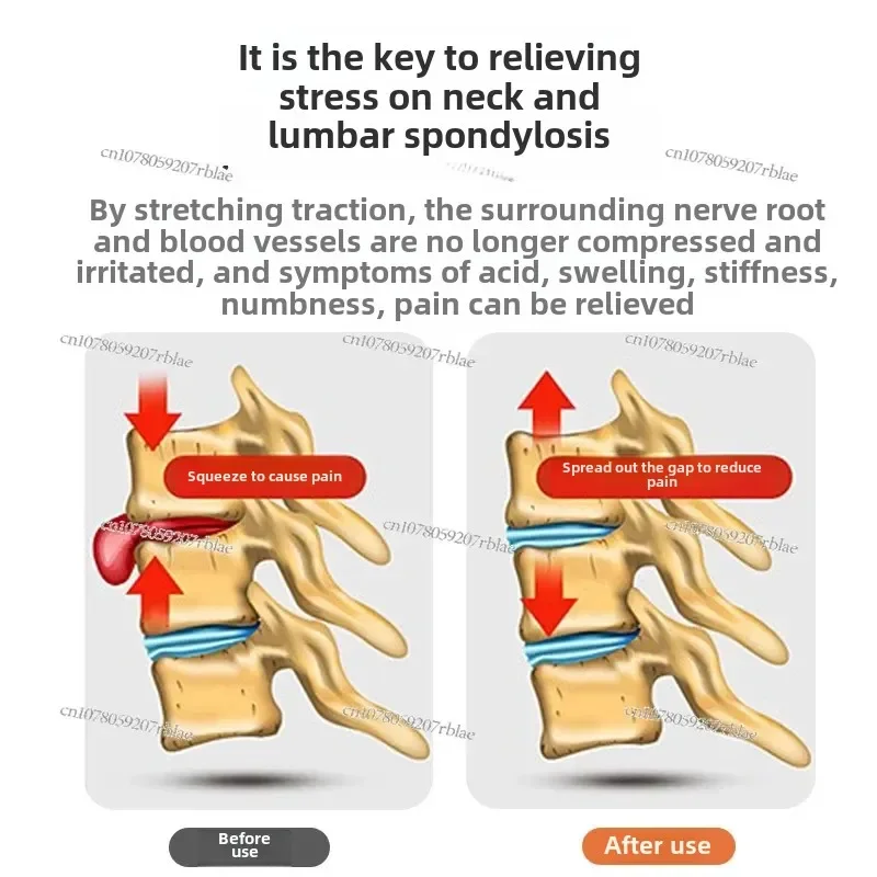 Traction Table Medical Protruding Tractor Auxiliary Treatment Cervical Spine Lumbar Disc Home Manual Tensioner