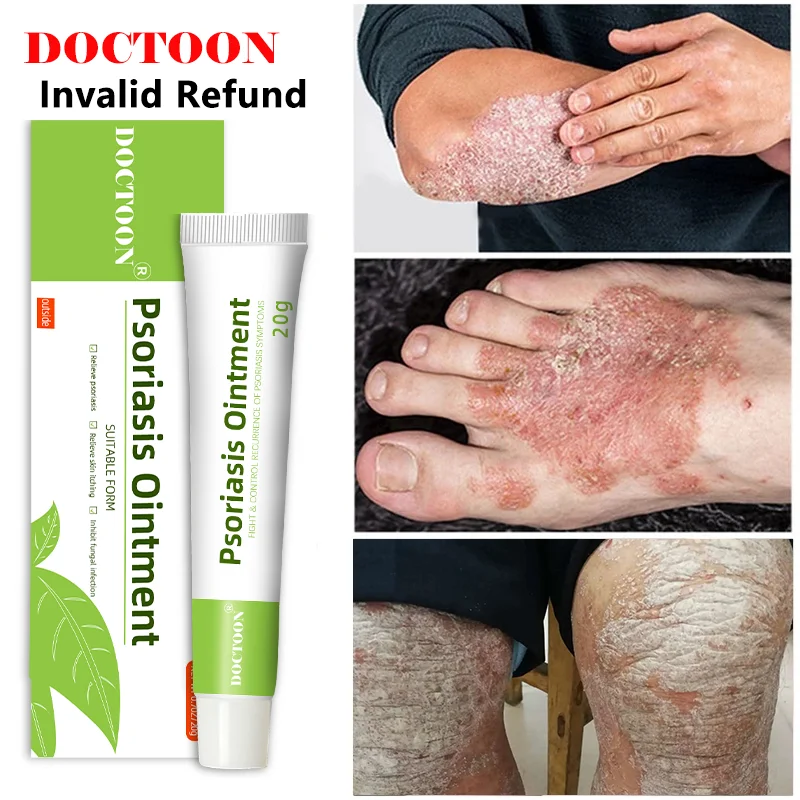 

Express service Cream psoriasisOintment from psoriasis DOCTOON Eczema Ointment Psoriasis Cream Hemorrhoids Antibacterial Herbal