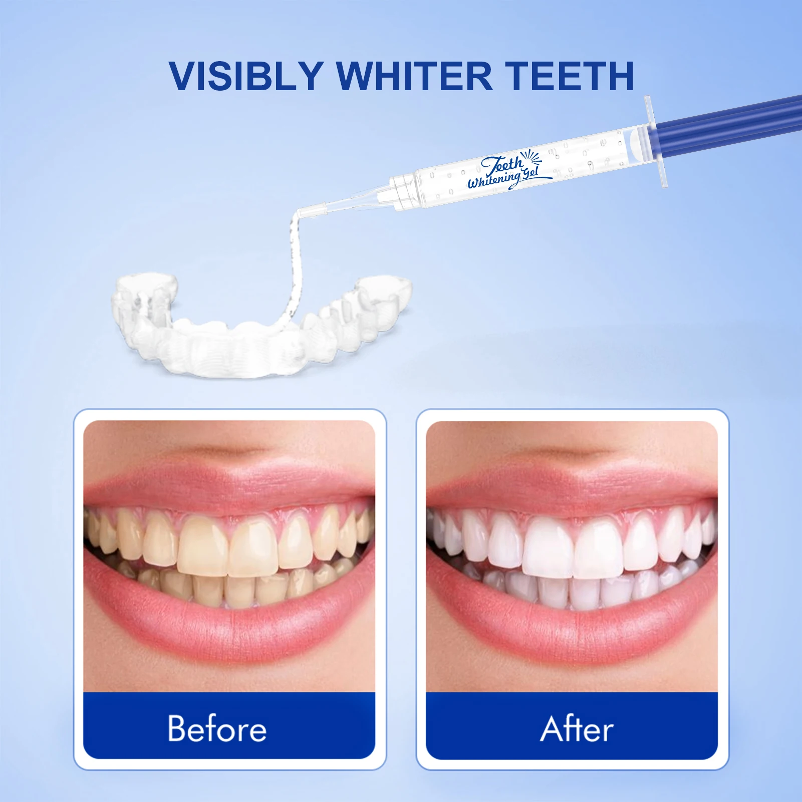 Teeth Whitening Gel 35% Carbamide Peroxide Dental Bleach Gel Oral Care Bleaching Tooth Whitener Gel Professional Clean 3mlX7pcs