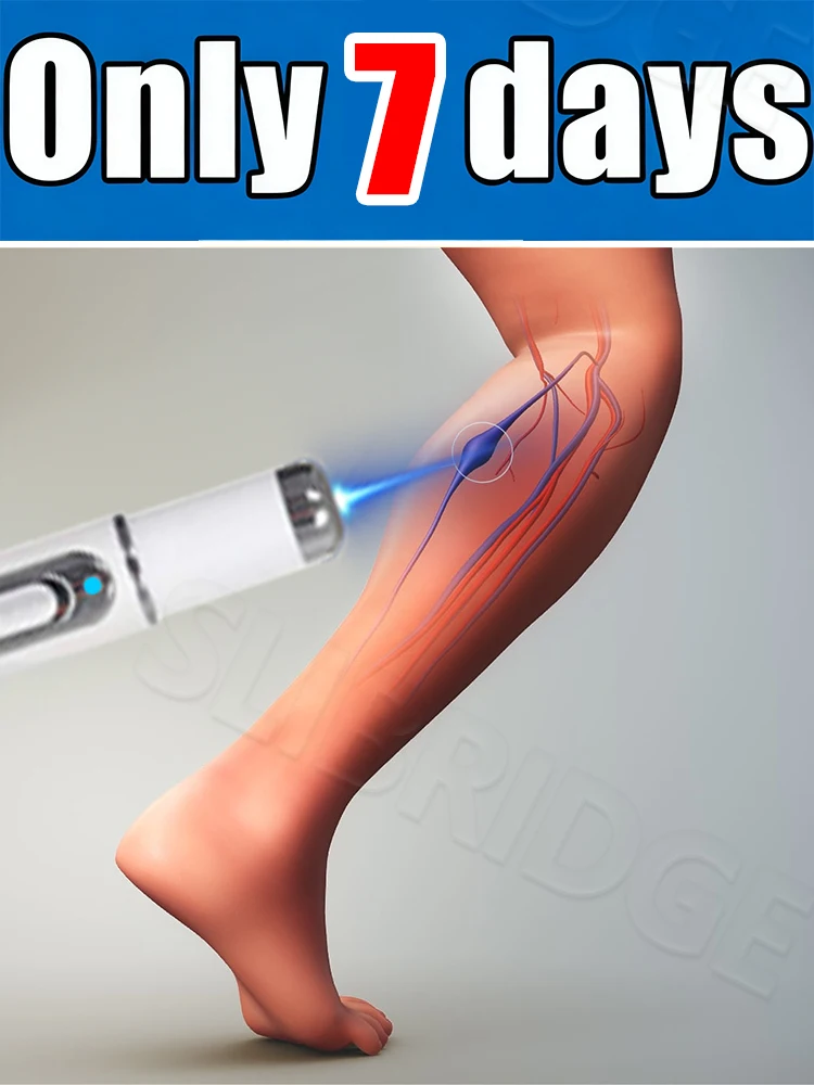 

Generation-2, ручка с синим светом, защищающая здоровье вен, в течение 7 дней