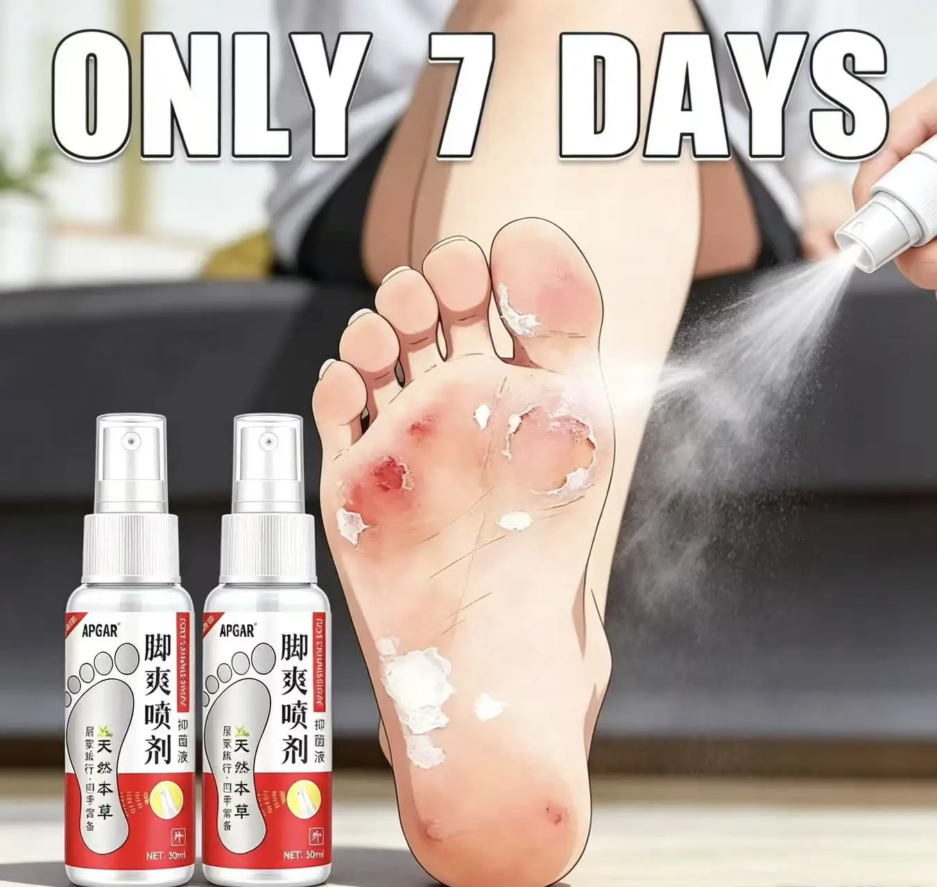Bacteriostatic Spray Yunnan Herb To Beriberi Feet Smelly Wolf Illness Spray Feet Peeling Rotten Feet Blisters Foot Care Tools