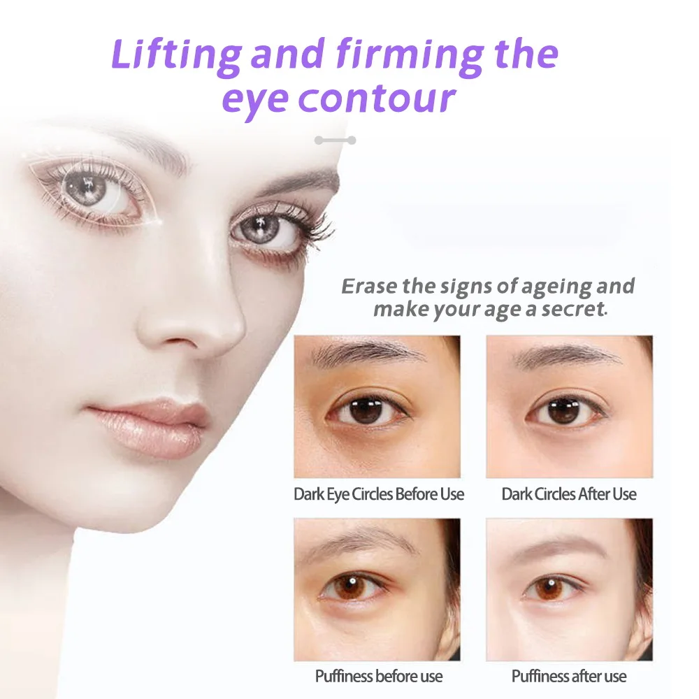 Intelligent oogtherapieapparaat - Warm kompres- en vibratiemassage voor donkere kringen en wallen