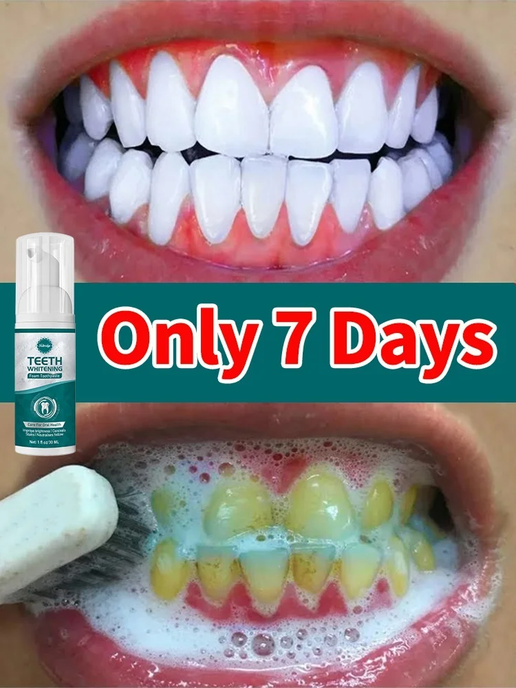 

Hot tartar removers dissolve tartar and remove stains solve to all troubles