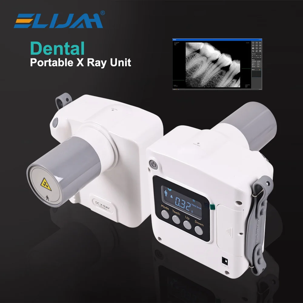 Everything You Need to Know About Portable Dental X-Ray Units