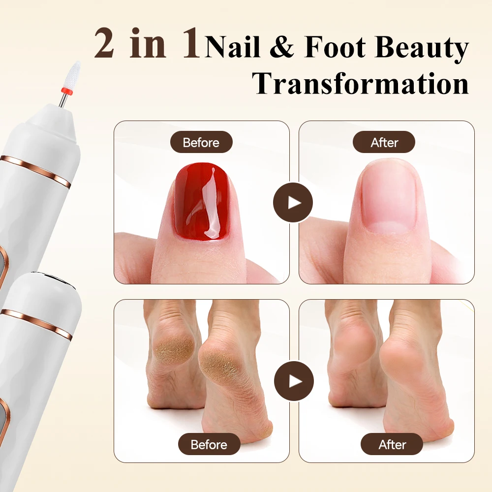 Electric Nail File And Callus Remover For Manicure And Pedicure_voghion.com