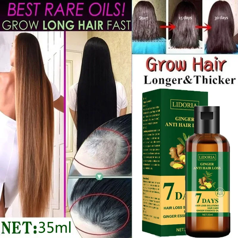 Aceite Esencial de jengibre para el crecimiento del cabello, suero anticaída para el crecimiento rápido del cabello, previene la calvicie, tratamiento para la Alopecia, producto para el cuidado del cabello