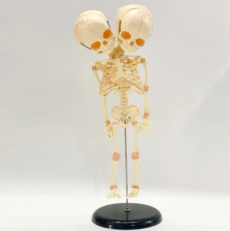 Free Ship37cm Human Double Head Baby Skull Skeleton Anatomy Brain Display Study Teaching Anatomical Model Halloween Bar Ornament