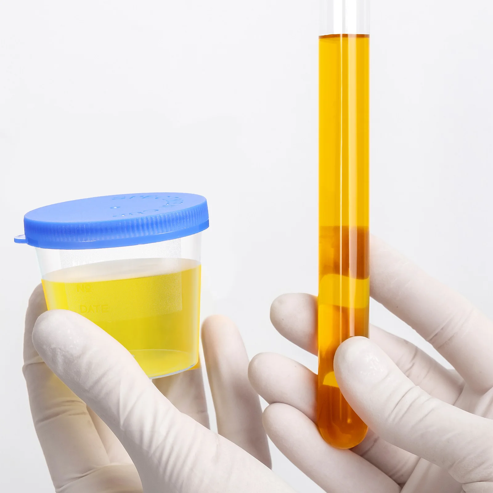 Sterile 40ML Disposable Specimen Cups 30pcs Sputum Sample Containers for Pregnancy Urine PH Testing Collection Cup Random