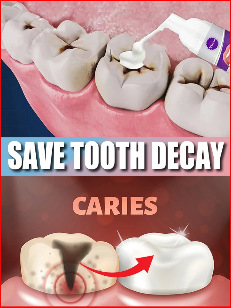 

Repair Tooth Decay