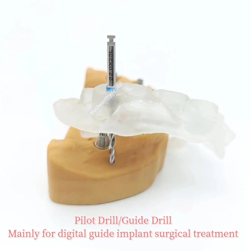φ2.0 Dental Pilot Drill with Guide Sleeve Digital Guided Implant Guide Drill Compatible Drill Tubes Sleeves Similar Dionavi Dio