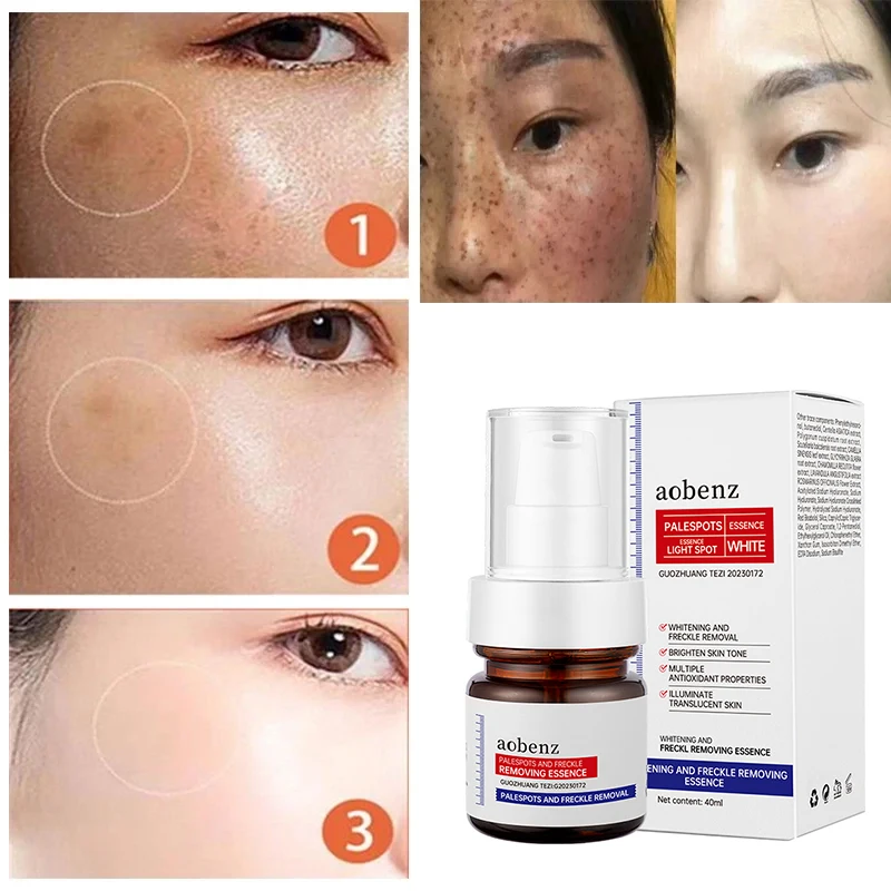 Krim Wajah pemutih Vitamin C, krim wajah menghilangkan Melasma bintik hitam mencerahkan Melanin jerawat bekas luka Anti Penuaan mencerahkan perawatan kulit Korea