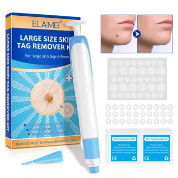 Auto Large Size Skin Tag Removal Kit For Large Skin Tags 4-9mm With Cleansing Swabs Home Use Face Skin Care Tool 1
