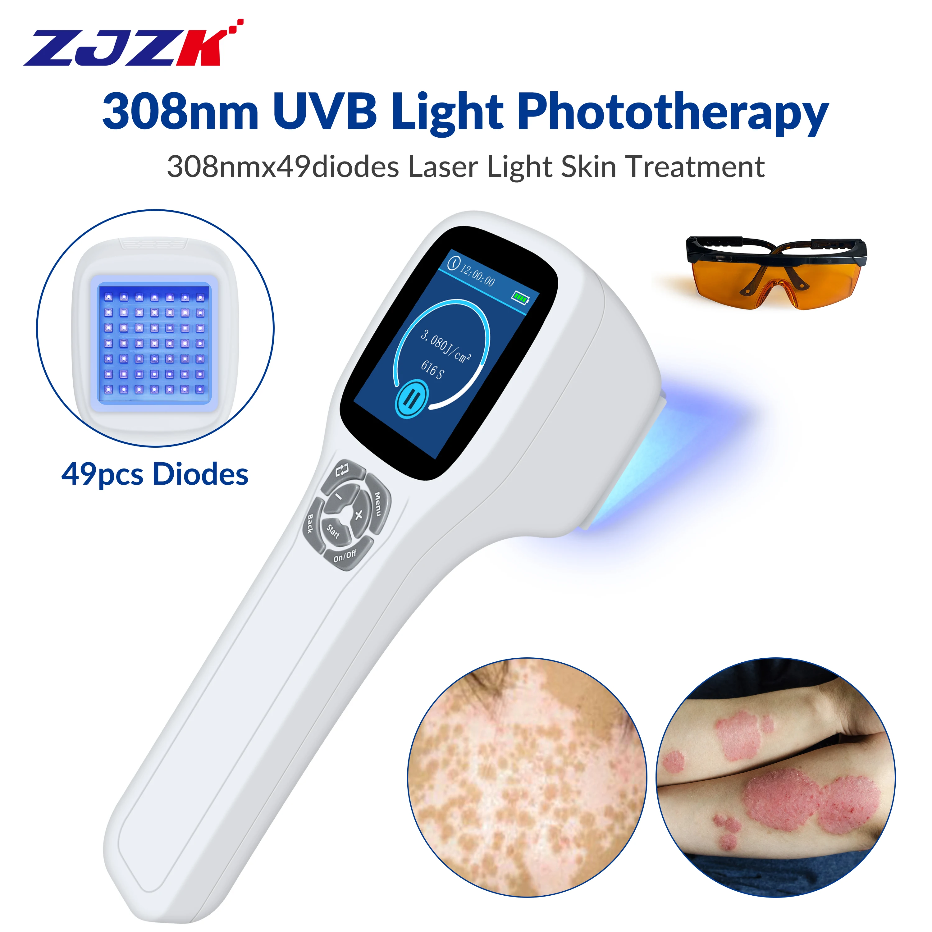 

ZJZK Best Skin Light Therapy Device UV Psoriasis 308nmx49diodes Narrow Band UVB For Vitiligo Pigmented Dermatitis Albinism