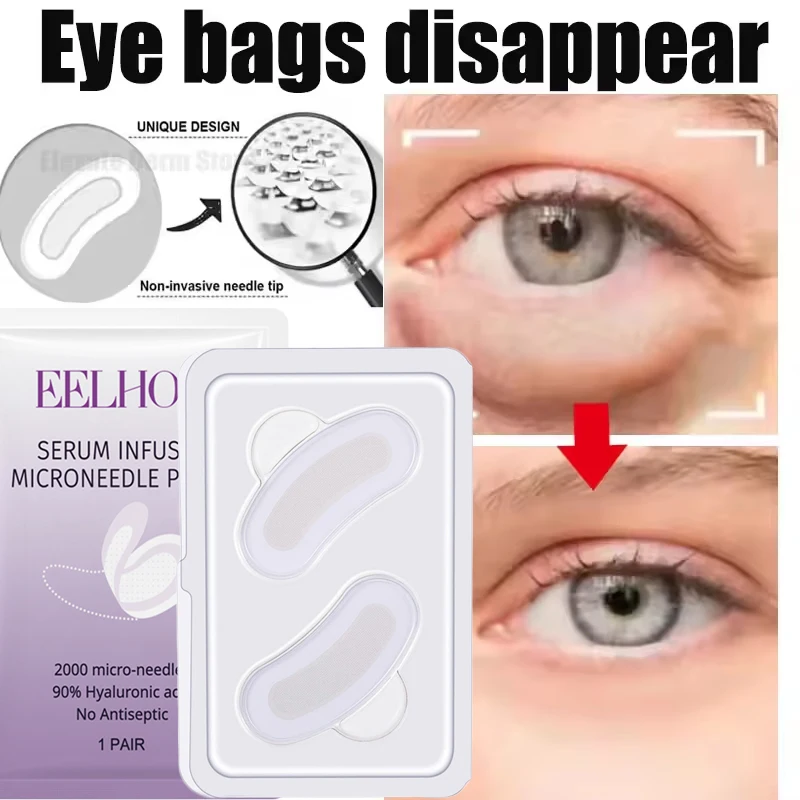 Microneedle Eye Patches หน้ากากกรดไฮยาลูโรนิกต่อต้านริ้วรอย Aging ลบถุงดวงตา Dark Circles Moisturizing Eye Gel Pads Skin Care