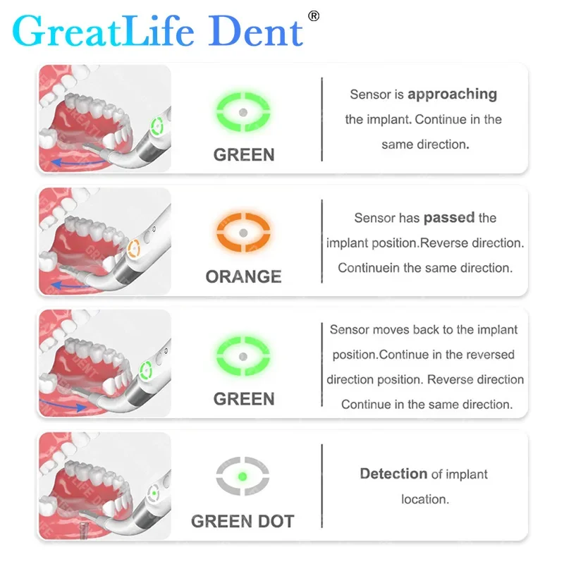 GreatLfie Dent ID1 Dental Implant Locator Cross-Scanning Spot Screwdriver Detector Tool 360 Rotatable Sensor Localization