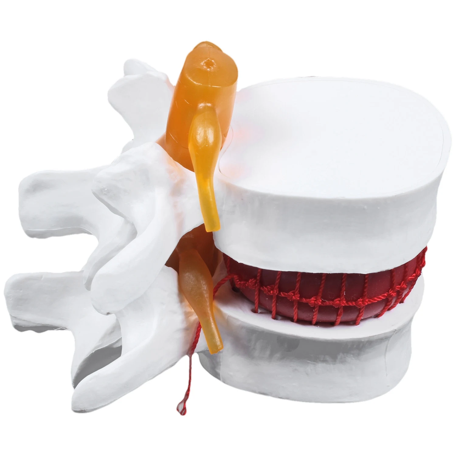 

Human Anatomy Skeleton Spine Lumbar Disc Herniation Teaching Model Brain Skull Traumatic School Supplies Instrume