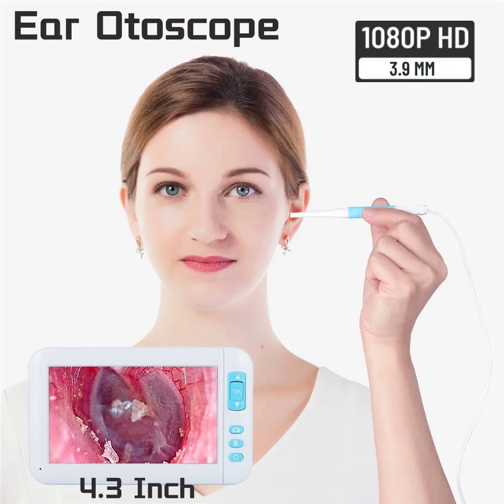 1080P HD Screen Otoscopio Camera Digital Earpick Ear Cleaner Monitor 3.9mm Endoscope Camera for Ear Inspection 4.3 Inch Display